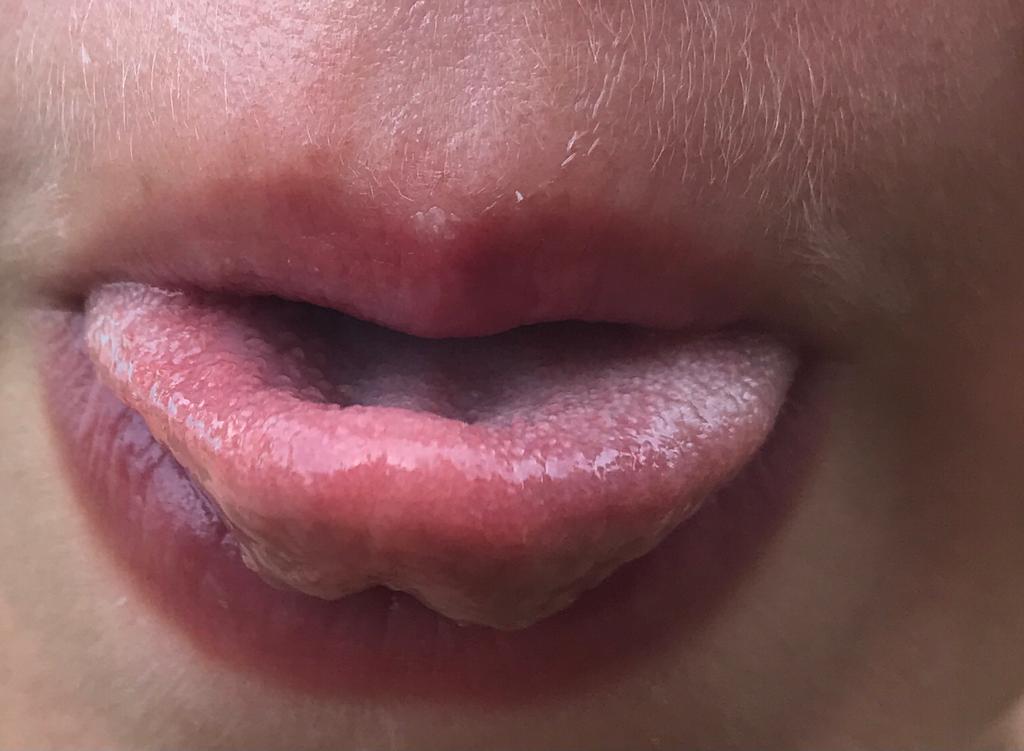 Boca sacando lengua